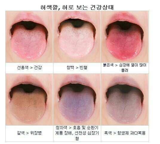 1384536034570.jpg 혀색깔 혀로 보는 건강상태.jpg